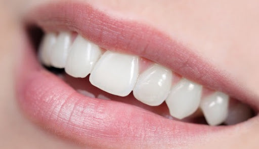 Les bienfaits d’un sourire plus blanc : pourquoi se blanchir les dents ?